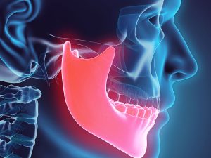 alveoloplasty for dental implants