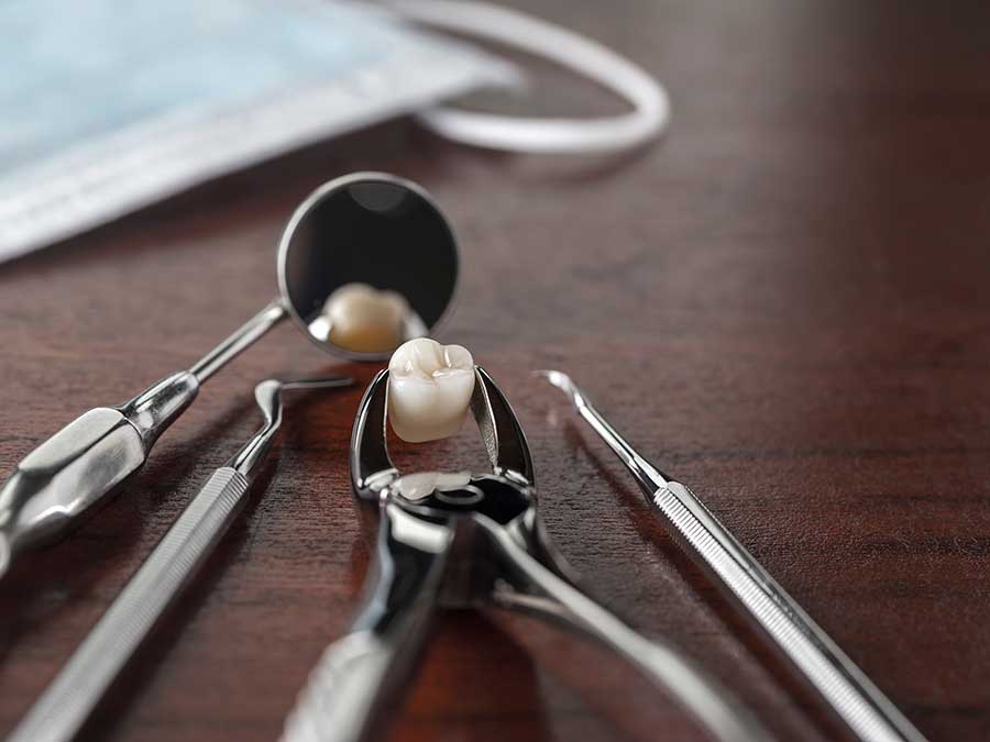 Role of Teeth Extractions