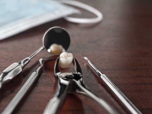 Challenges of Teeth Extractions