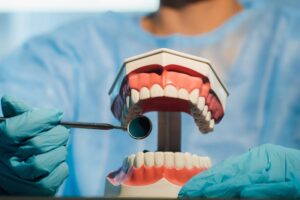 Navigating Impacted Canine Treatment: Fort Worth Oral Surgery’s Expert Guide