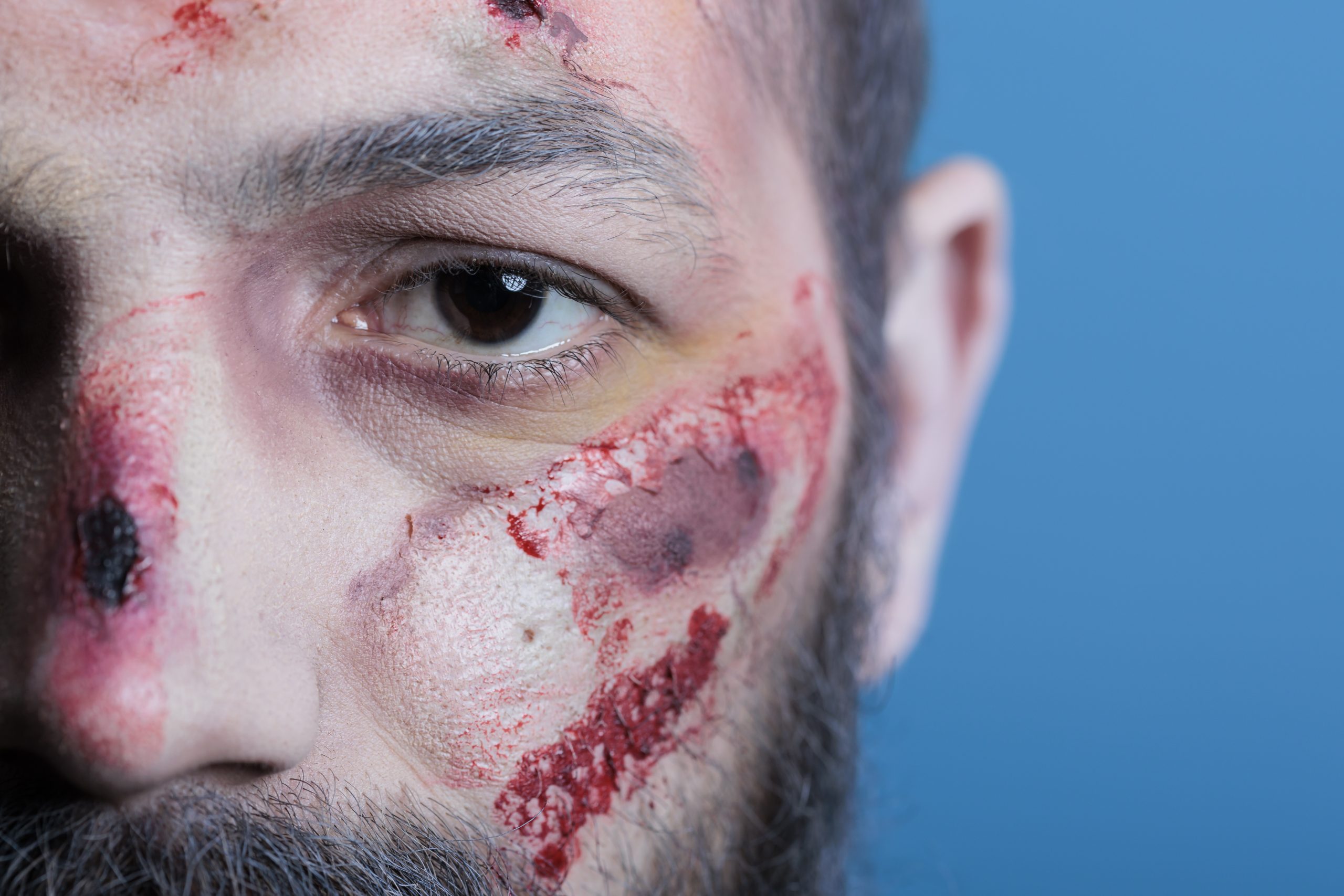 Facial Trauma Recovery Care: Fort Worth Oral Surgery’s Comprehensive Guide for Lasting Healing