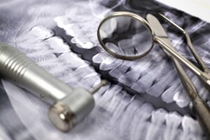 Panoramic X-Ray and dentist's medical equipment tools
