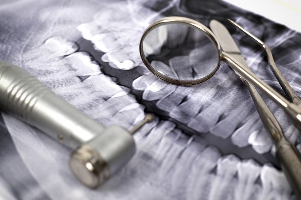 Panoramic X-Ray and dentist's medical equipment tools