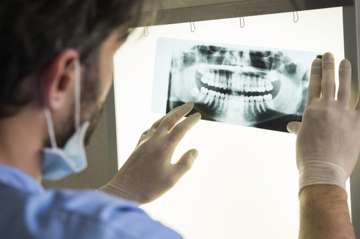 Closeup of dentist looking at dental x-ray plate