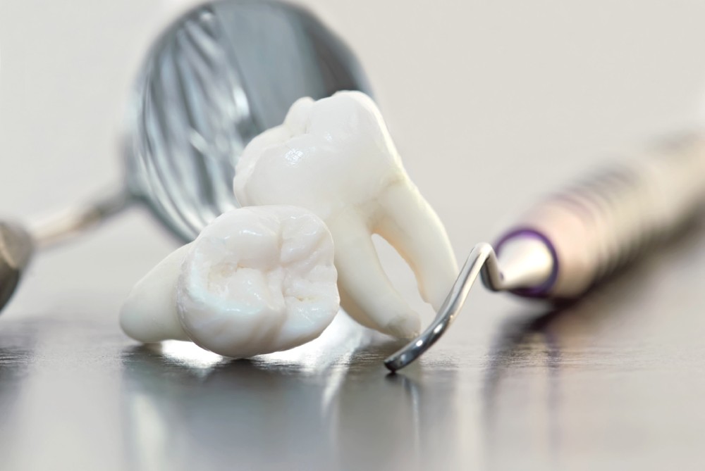 wisdom teeth